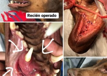 Imágenes de la operación de Leo.