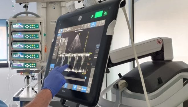 Un ecógrafo de Can Misses.