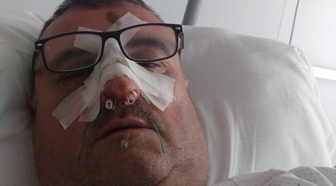 El sanitario agredido, tras la intervención a la que ha sido sometido, en una imagen subida por su familiar a Twitter para denunciar la situación.