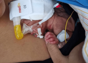 William James, el pequeño prematuro y su madre han estado desde finales de noviembre en Suiza.