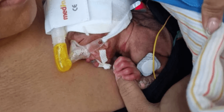 William James, el pequeño prematuro y su madre han estado desde finales de noviembre en Suiza.