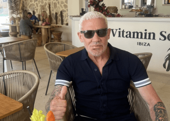 Wayne Lineker, con la cara magullada y un gesto de 'todo ok' para tranquilizar a toda la gente preocupada tras su agresión.