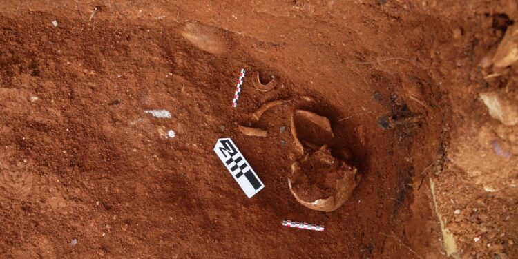 Cráneo de hombre adulto con fracturas compatibles con lesiones por arma de fuego.