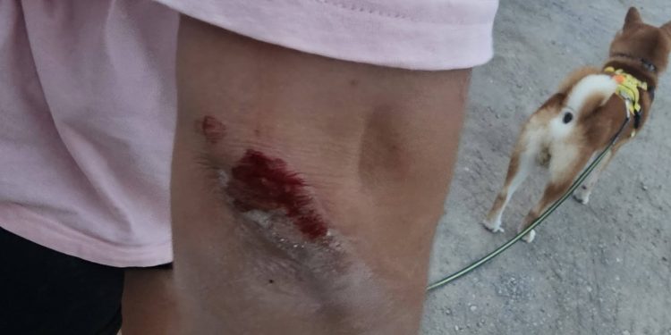Imagen publicada por la denunciante en redes sociales tras el ataque de esta mañana. Foto: Grandjean Grandjean / FB.